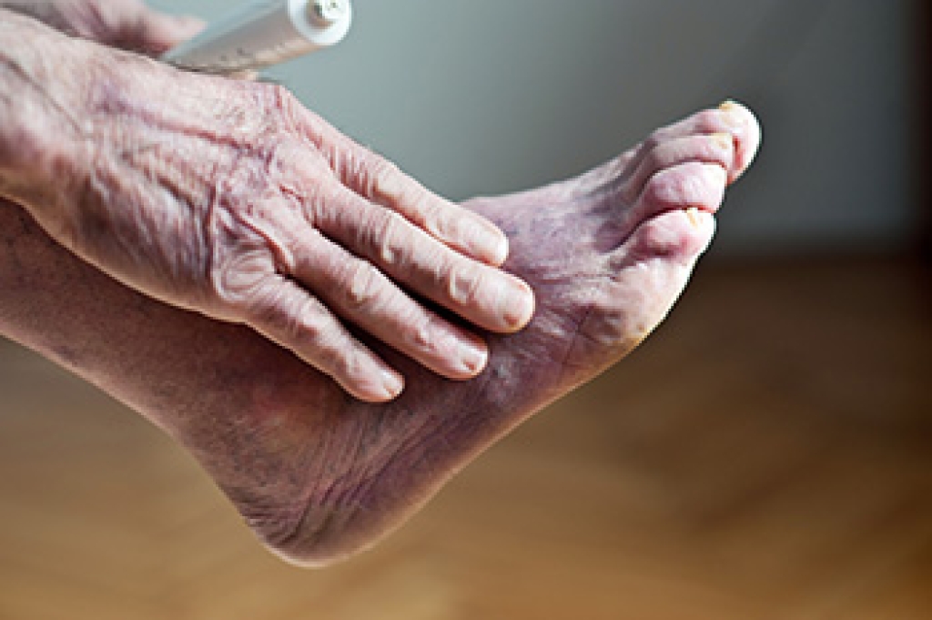 Poor Circulation in the Feet and Why It Matters