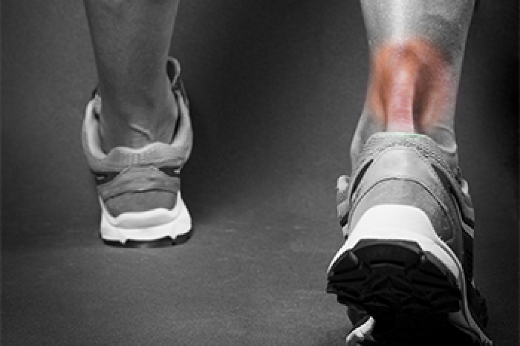 Causes of Achilles Tendon Injuries