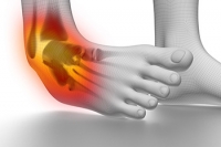Identifying Common Symptoms of Ankle Sprains